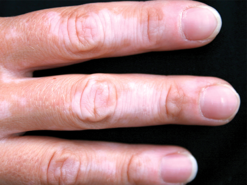 Health tips: Not just skin deep