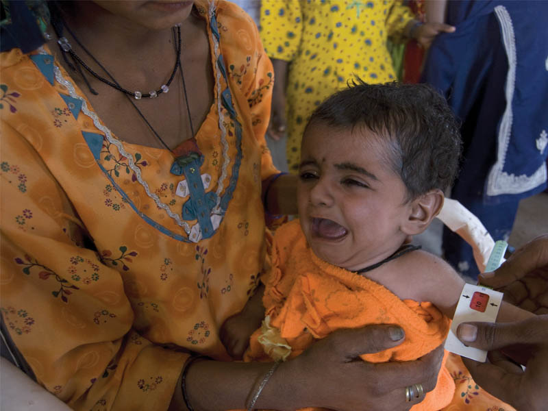 In Badin, Pakistan’s most malnourished children rely on energy biscuits