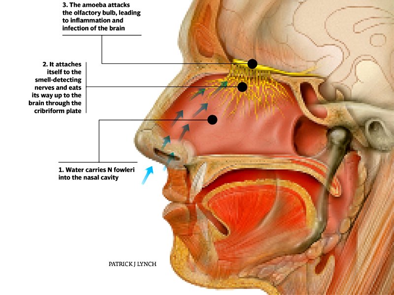 Karachi’s water has small quantities of the brain-eating amoeba — here’s how to do wuzu safely.