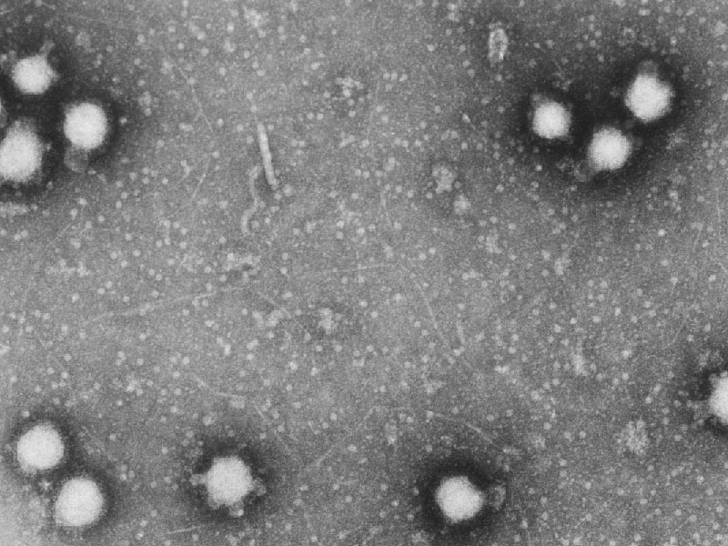 Congo virus in Balochistan