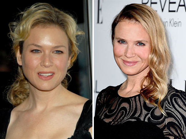 Give Renee Zellweger a break!
