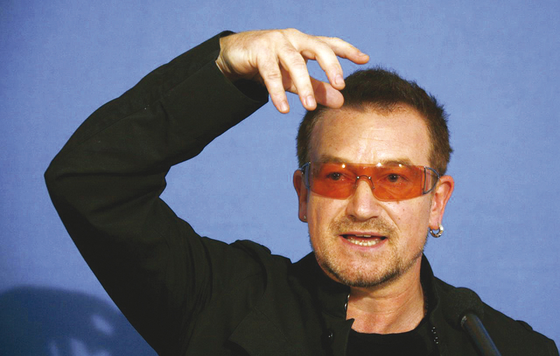 U2’s Bono fitted with metal plates, screws after bike accident