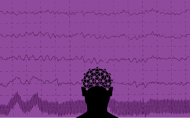 Patients with epilepsy can lead normal lives if the disease is diagnosed and treated on time. DESIGN : OMER ASIM