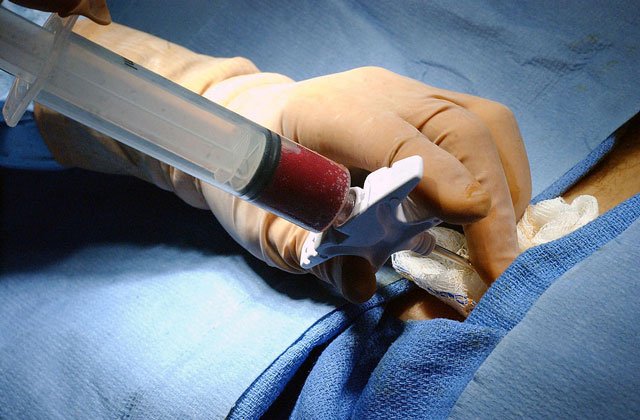 Prof Dr Tahir Shamsi will coordinate with the institute’s management to finalise the arrangements for the first ever bone marrow transplantation in the Punjab as Punjab Chief Minister Shahbaz Sharif has sought his assistance in establishing a bone marrow centre in the province. PHOTO: FILE