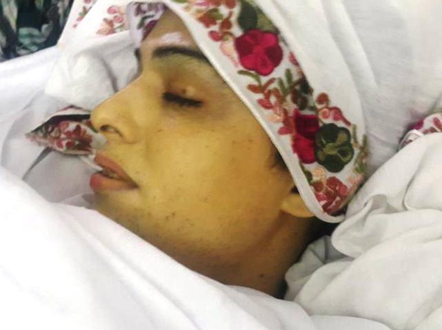 Alisha was treated outside a lavatory – shame on you, Peshawar