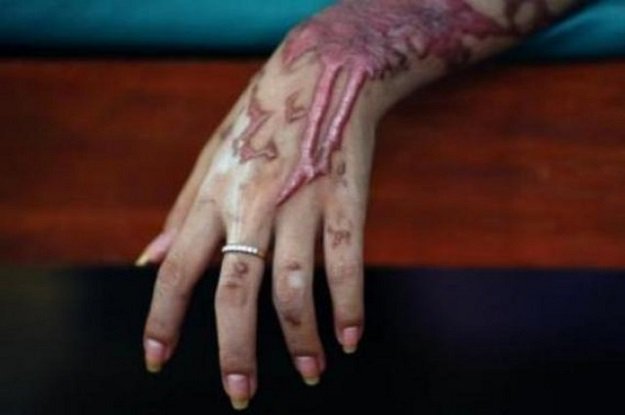 The suspects are facing trials over all the attacks, but were released on bail in April. PHOTO: File