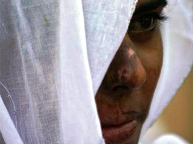 K-P submits draft law to curb acid attacks